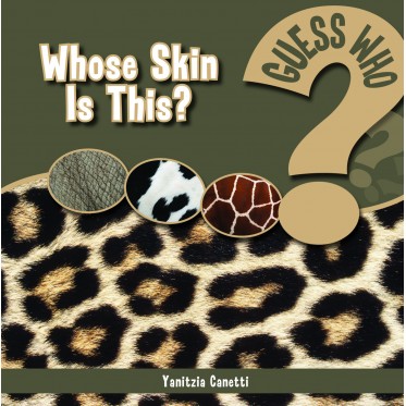 Whose Skin Is This?